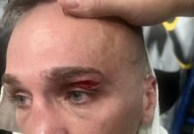 Naoya Inoue vs Ye Joon Kim: a qué hora pelea el Monstruo japonés, cómo verlo en vivo y qué títulos pone en juego