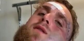Jake Paul mostró cómo tiene la cara a cinco días del nocaut de Anthony Joshua que le destruyó la mandíbula