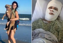 Víctima de ataque con químico corrosivo en EE.UU. enfrenta facturas médicas millonarias